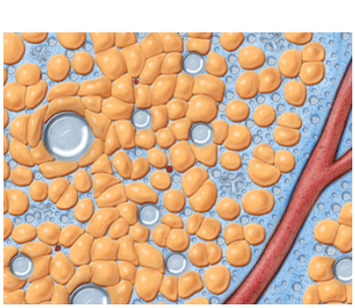 VASERlipo fragmentation